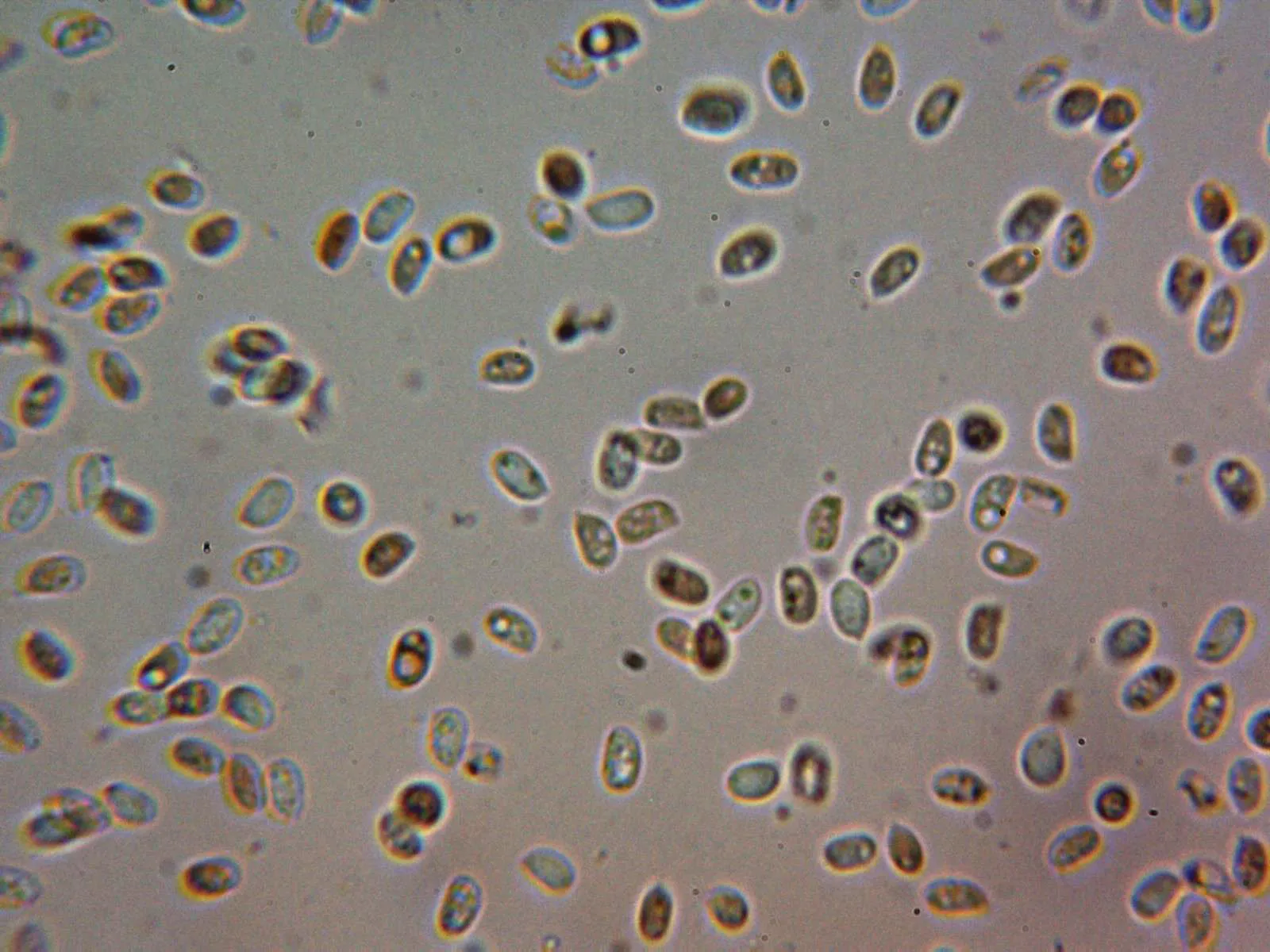 Microscopía de Phlebia rufa - 10 - Esporas r c concentrado